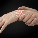 Hypocalcemia: What are The Causes and Symptoms of Calcium Deficiency?
